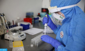وباء كوفيد-19 كان موجودا في إيطاليا منذ أكثر من عام (دراسة)